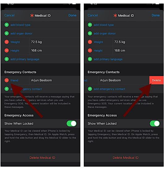 Cómo eliminar un contacto de emergencia en Apple Watch y en iPhone